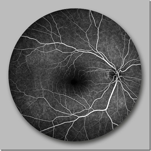 Angiographie des Auges