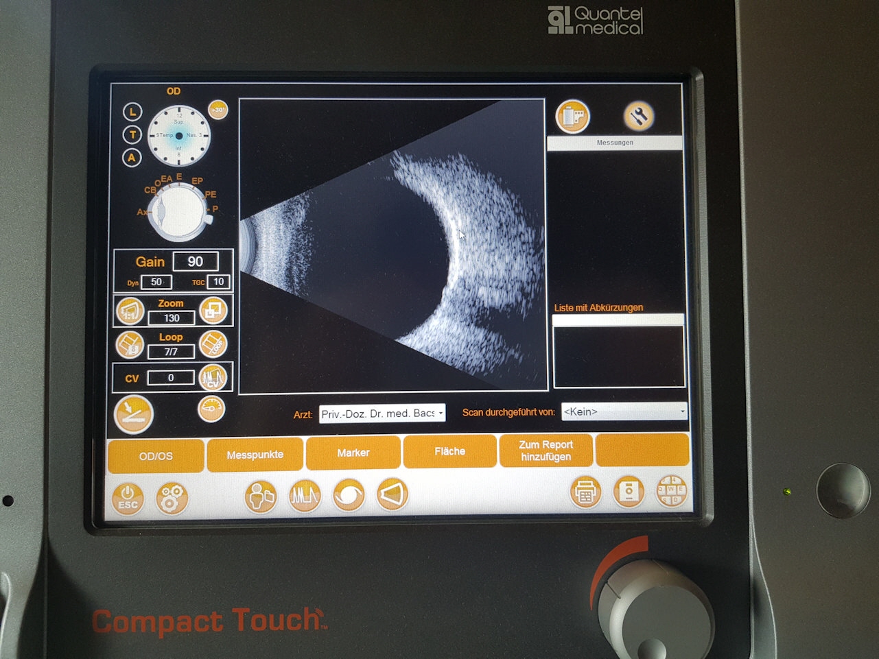 Ultraschall Untersuchung des Auges